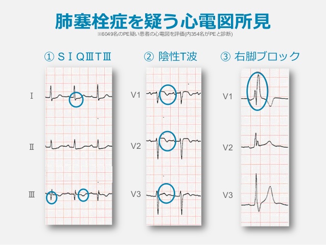 妊娠に関する考慮事項